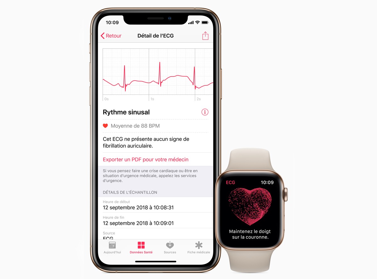 Apple Watch Series 4 Ecg